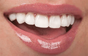 perfect teeth