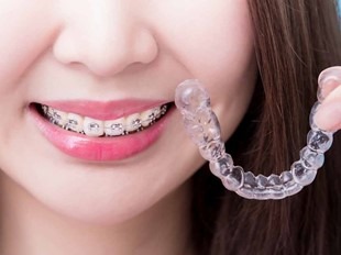 braces or invisalign