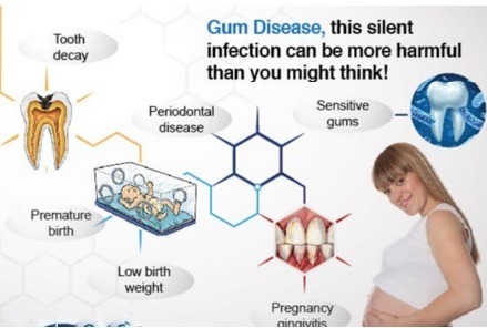 Healthy Teeth and Gums in Pregnancy - Koowerup Dental Surgery